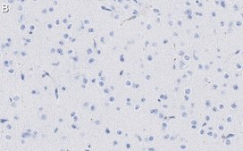 Anti-MAP2 Antibody, clone AP20 ZooMAb&#174; Mouse Monoclonal recombinant, expressed in HEK 293 cells
