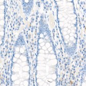 Anti-MRP1/ABCC1 Antibody, clone 0J6M2, Rabbit Monoclonal