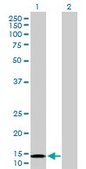 Anti-NDUFB6 antibody produced in rabbit purified immunoglobulin, buffered aqueous solution