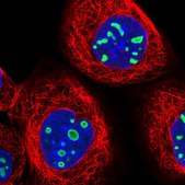 Anti-EBNA1BP2 antibody produced in rabbit Prestige Antibodies&#174; Powered by Atlas Antibodies, affinity isolated antibody, buffered aqueous glycerol solution