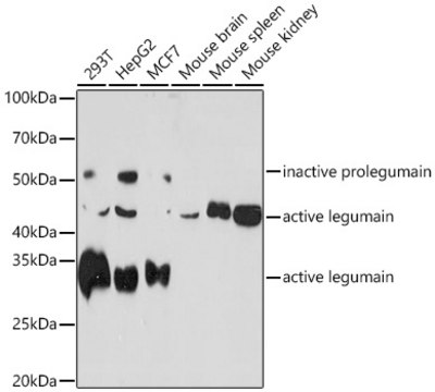 Anti-Legumain (LGMN) Antibody, clone 6X5U6, Rabbit Monoclonal