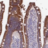 Anti-ETFDH antibody produced in rabbit Prestige Antibodies&#174; Powered by Atlas Antibodies, affinity isolated antibody, buffered aqueous glycerol solution