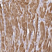 Anti-MYOM2 antibody produced in rabbit Prestige Antibodies&#174; Powered by Atlas Antibodies, affinity isolated antibody, buffered aqueous glycerol solution