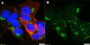 Anti-&#945;-amylase Antibody, clone 1G14 ZooMAb&#174; Rabbit Monoclonal recombinant, expressed in HEK 293 cells