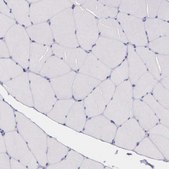 Anti-THSD7A antibody produced in rabbit Prestige Antibodies&#174; Powered by Atlas Antibodies, affinity isolated antibody, buffered aqueous glycerol solution