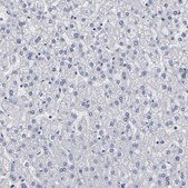 Anti-FABP4 antibody produced in rabbit Prestige Antibodies&#174; Powered by Atlas Antibodies, affinity isolated antibody, buffered aqueous glycerol solution