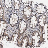 Anti-CYB561 antibody produced in rabbit Prestige Antibodies&#174; Powered by Atlas Antibodies, affinity isolated antibody, buffered aqueous glycerol solution