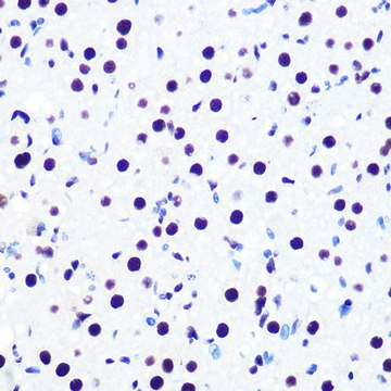 Anti-DDX5 antibody produced in rabbit