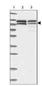 Anti-NVL antibody produced in rabbit Prestige Antibodies&#174; Powered by Atlas Antibodies, affinity isolated antibody, buffered aqueous glycerol solution