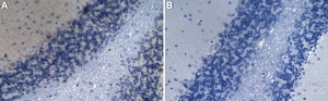 Anti-Tbr1-Antikörper from rabbit, purified by affinity chromatography