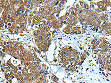 Anti-UBE2D3 affinity isolated antibody