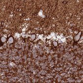 Anti-ATP1A3 antibody produced in rabbit Prestige Antibodies&#174; Powered by Atlas Antibodies, affinity isolated antibody, buffered aqueous glycerol solution