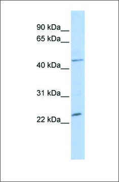 Anti-NKX3-1 (ab2) antibody produced in rabbit affinity isolated antibody