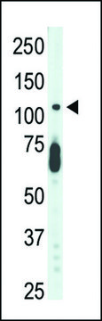 ANTI-CDKL5 (STK9)(C-TERMINAL) antibody produced in rabbit IgG fraction of antiserum, buffered aqueous solution