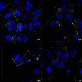 Monoclonal Anti-Tarp Gamma2/4/8 (Stargazin) - Rpe antibody produced in mouse clone S245-36, purified immunoglobulin
