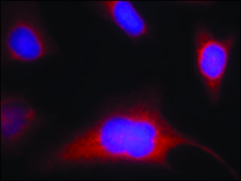 Anti-phospho-PRKD1 (pSer910) antibody produced in rabbit affinity isolated antibody