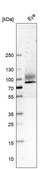 Monoclonal Anti-ITGB8 antibody produced in mouse Prestige Antibodies&#174; Powered by Atlas Antibodies, clone CL7290, purified immunoglobulin, buffered aqueous glycerol solution