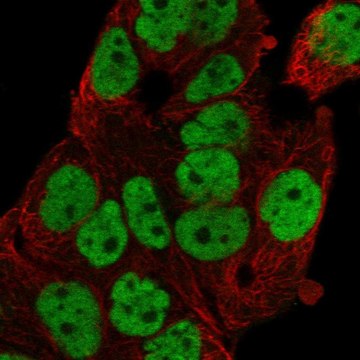 Anti-Foxp4 Antibody Produced In Rabbit Prestige Antibodies&#174; Powered by Atlas Antibodies, affinity isolated antibody, buffered aqueous glycerol solution