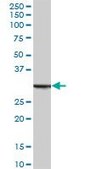 Anti-ANXA5 antibody produced in mouse purified immunoglobulin, buffered aqueous solution