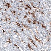 Monoclonal Anti-MUC5AC antibody produced in mouse Prestige Antibodies&#174; Powered by Atlas Antibodies, clone CL8961, purified immunoglobulin, buffered aqueous glycerol solution