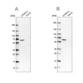 Anti-UPF3B antibody produced in rabbit Ab2, Prestige Antibodies&#174; Powered by Atlas Antibodies, affinity isolated antibody, buffered aqueous glycerol solution