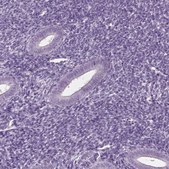 Anti-CABP5 antibody produced in rabbit Prestige Antibodies&#174; Powered by Atlas Antibodies, affinity isolated antibody, buffered aqueous glycerol solution