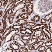 Anti-GSTM1 antibody produced in rabbit Prestige Antibodies&#174; Powered by Atlas Antibodies, affinity isolated antibody, buffered aqueous glycerol solution