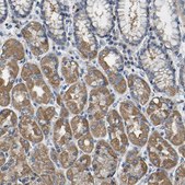 Anti-AGK antibody produced in rabbit Prestige Antibodies&#174; Powered by Atlas Antibodies, affinity isolated antibody, buffered aqueous glycerol solution