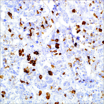 Prolactin Rabbit Polyclonal Antibody