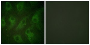 Anti-KIR6.2 antibody produced in rabbit affinity isolated antibody