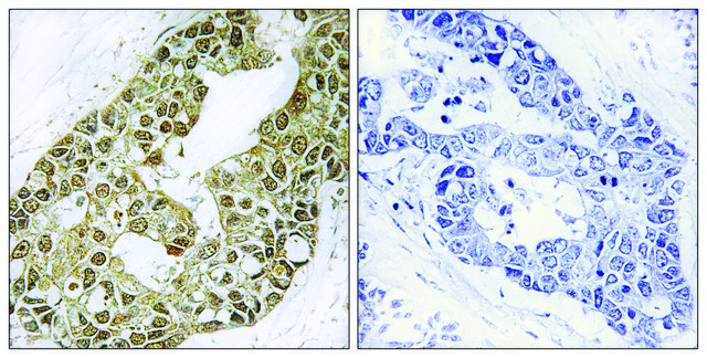 Anti-I&#954;B-&#945; antibody produced in rabbit affinity isolated antibody