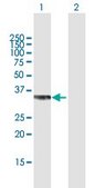 Anti-PPP2CB antibody produced in mouse purified immunoglobulin, buffered aqueous solution