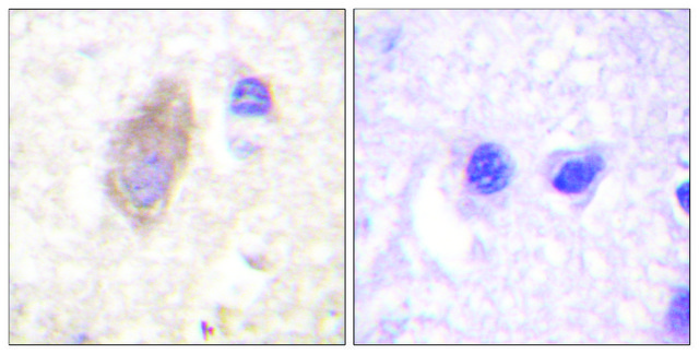 Anti-Rabphilin 3A antibody produced in rabbit affinity isolated antibody