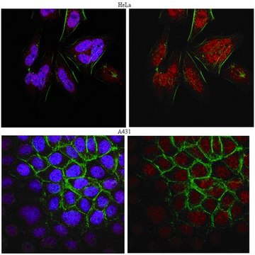 Anti-BRCA1 Antibody, clone MS13 clone MS13, from mouse