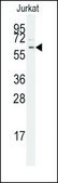 Anti-TGFBR1 (center) antibody produced in rabbit IgG fraction of antiserum, buffered aqueous solution