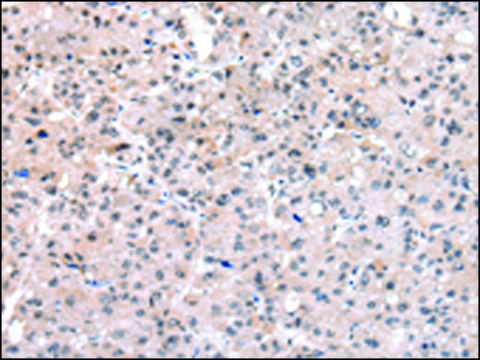 Anti-SETMAR affinity isolated antibody