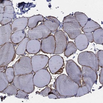 Anti-Cav3 Antibody Produced In Rabbit Prestige Antibodies&#174; Powered by Atlas Antibodies, affinity isolated antibody, buffered aqueous glycerol solution