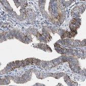 Anti-SLCO4A1 antibody produced in rabbit Prestige Antibodies&#174; Powered by Atlas Antibodies, affinity isolated antibody, buffered aqueous glycerol solution