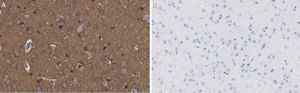 Anti-Tau-1 Antibody, clone PC1C6 ZooMAb&#174; Mouse Monoclonal recombinant, expressed in HEK 293 cells