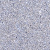 Anti-CCDC88A antibody produced in rabbit Prestige Antibodies&#174; Powered by Atlas Antibodies, affinity isolated antibody, buffered aqueous glycerol solution