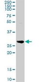 Anti-NNMT antibody produced in rabbit purified immunoglobulin, buffered aqueous solution