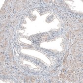 Anti-FGFR2 antibody produced in rabbit Prestige Antibodies&#174; Powered by Atlas Antibodies, affinity isolated antibody, buffered aqueous glycerol solution