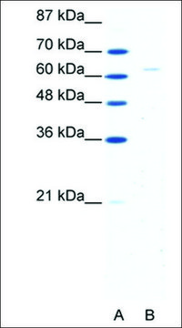 Anti-FOXN1 IgG fraction of antiserum