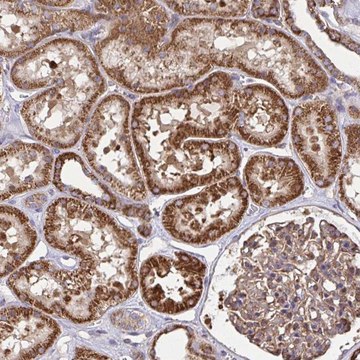 Anti-NMNAT3 antibody produced in rabbit Prestige Antibodies&#174; Powered by Atlas Antibodies, affinity isolated antibody, buffered aqueous glycerol solution
