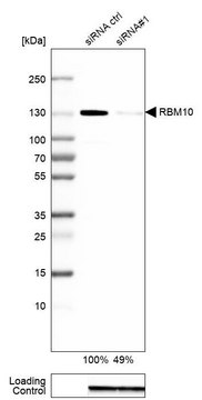 Anti-RBM10 antibody produced in rabbit Prestige Antibodies&#174; Powered by Atlas Antibodies, affinity isolated antibody, buffered aqueous glycerol solution