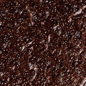 Monoclonal Anti-PTEN antibody produced in mouse Prestige Antibodies&#174; Powered by Atlas Antibodies, clone CL11723, purified immunoglobulin, buffered aqueous glycerol solution