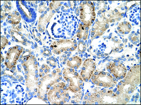 Anti-MUC1 affinity isolated antibody