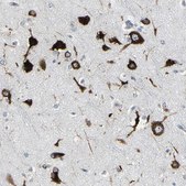 Anti-G3BP2 antibody produced in rabbit Prestige Antibodies&#174; Powered by Atlas Antibodies, affinity isolated antibody, buffered aqueous glycerol solution