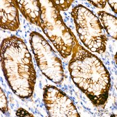 Anti-Cytokeratin 20 (KRT20) Antibody, clone 8C6A3, Rabbit Monoclonal