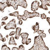 Monoclonal Anti-SMAD4 antibody produced in mouse Prestige Antibodies&#174; Powered by Atlas Antibodies, clone CL9774, purified immunoglobulin, buffered aqueous glycerol solution